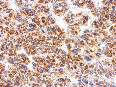 Immunohistochemistry-Paraffin: CXCR1/IL-8RA Antibody [NBP2-16043]
