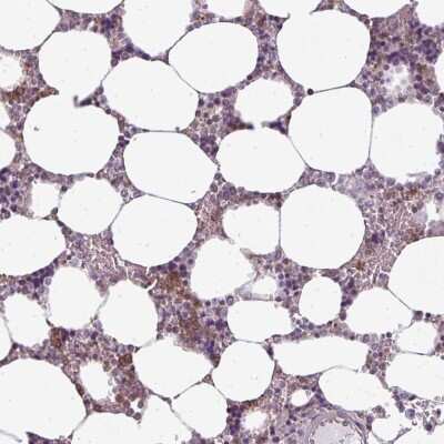 Immunohistochemistry-Paraffin: CXCR1/IL-8RA Antibody [NBP2-48621]