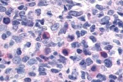 Immunohistochemistry-Paraffin: CXCR1/IL-8RA Antibody - BSA Free [NLS806]