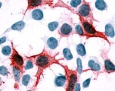 Immunohistochemistry-Paraffin: CXCR1/IL-8RA Antibody - BSA Free [NLS806]