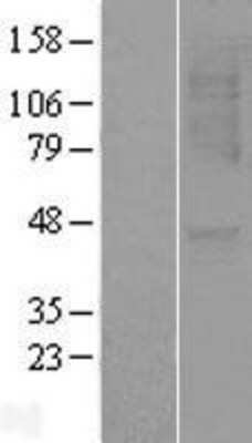 Western Blot: CXCR1/IL-8RA Overexpression Lysate [NBL1-11968]