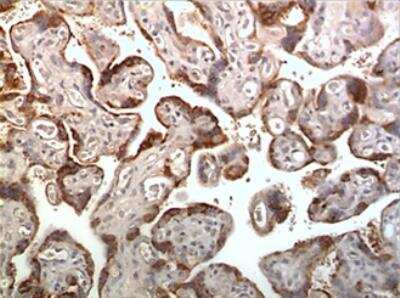 Immunohistochemistry-Paraffin: CXCR2/IL-8RB Antibody (MM0222-7J40) - Azide and BSA Free [NBP2-12413]