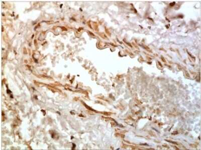 Immunohistochemistry-Paraffin: CXCR2/IL-8RB Antibody (RM0212-24D12) - Azide and BSA Free [NBP2-12238]