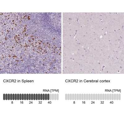 Immunohistochemistry-Paraffin: CXCR2/IL-8RB Antibody [NBP2-38195]