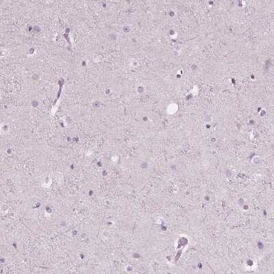 Immunohistochemistry-Paraffin: CXCR2/IL-8RB Antibody [NBP2-38195]
