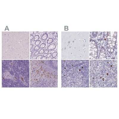 Immunohistochemistry-Paraffin: CXCR2/IL-8RB Antibody [NBP2-38195]