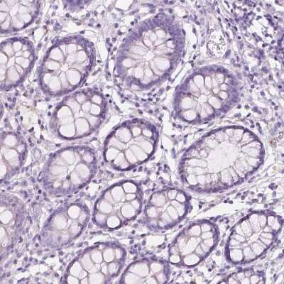 Immunohistochemistry-Paraffin: CXCR2/IL-8RB Antibody [NBP2-38195]