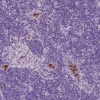Immunohistochemistry-Paraffin: CXCR2/IL-8RB Antibody [NBP2-38195]