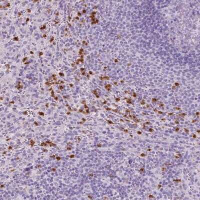 Immunohistochemistry-Paraffin: CXCR2/IL-8RB Antibody [NBP2-38195]