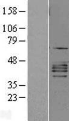 Western Blot: CXCR2/IL-8RB Overexpression Lysate [NBL1-11969]