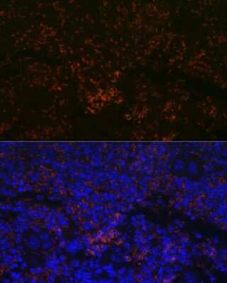 Immunohistochemistry: CXCR3 Antibody (3B7Y7) [NBP3-15369]