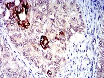 Immunohistochemistry: CXCR3 Antibody (5C10E6) - BSA Free [NBP2-61681]