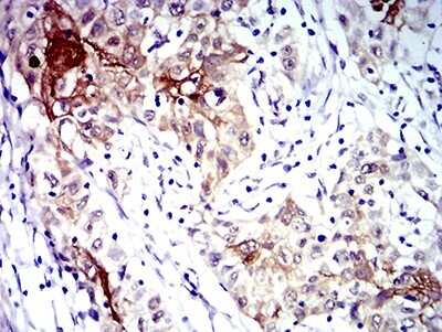 Immunohistochemistry: CXCR3 Antibody (5C10E6) - BSA Free [NBP2-61681]