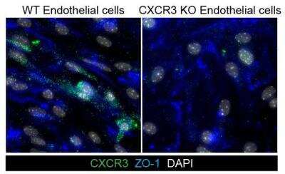 Immunocytochemistry/ Immunofluorescence: CXCR3 Antibody [NB100-56404]