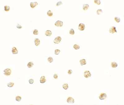 Immunocytochemistry/ Immunofluorescence: CXCR3 Antibody - BSA Free [NBP2-41250]