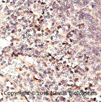 Immunohistochemistry-Paraffin: CXCR3 Antibody [NB100-56404]