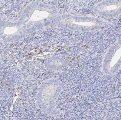 Immunohistochemistry-Paraffin: CXCR3 Antibody [NBP2-38547]