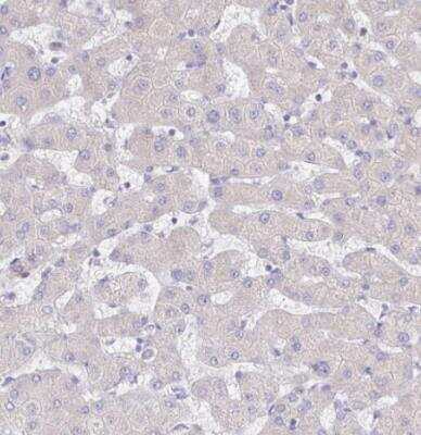 Immunohistochemistry-Paraffin: CXCR3 Antibody [NBP2-38547]
