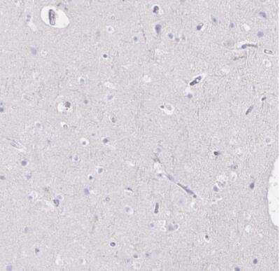Immunohistochemistry-Paraffin: CXCR3 Antibody [NBP2-38547]