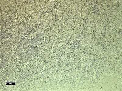 Immunohistochemistry-Paraffin: CXCR3 Antibody [NBP2-77442]