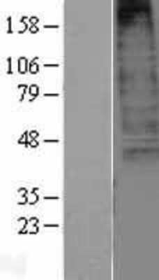 Western Blot: CXCR3 Overexpression Lysate [NBL1-09631]