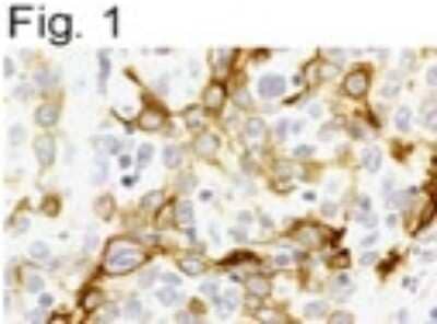 Immunohistochemistry: CXCR4 Antibody [NB100-74396]