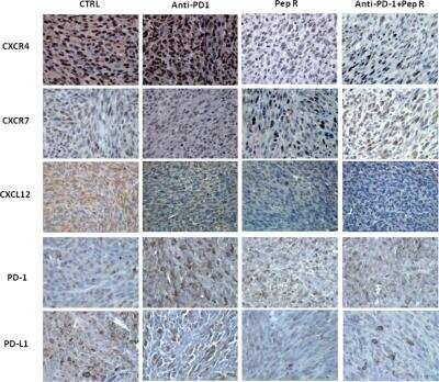 Immunohistochemistry: CXCR4 Antibody [NB100-74396]