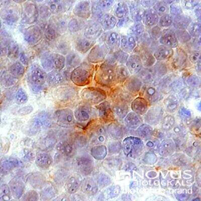 Immunohistochemistry-Paraffin: CXCR4 Antibody [NB100-56437]