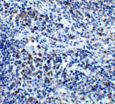 Immunohistochemistry-Paraffin: CXCR4 Antibody - BSA Free [NBP1-76480]