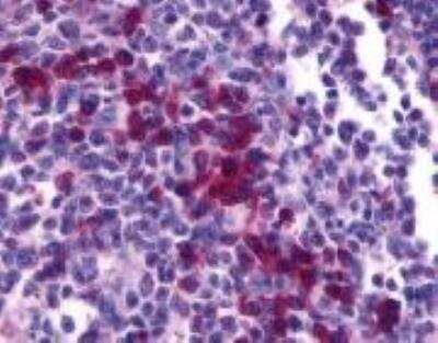 Immunohistochemistry-Paraffin: CXCR4 Antibody - BSA Free [NLS1380]