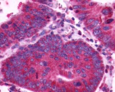 Immunohistochemistry-Paraffin: CXCR4 Antibody - BSA Free [NLS1380]