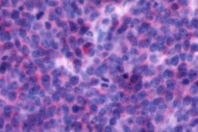 Immunohistochemistry-Paraffin: CXCR4 Antibody - BSA Free [NLS1380]