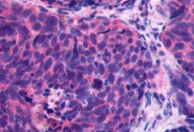 Immunohistochemistry-Paraffin: CXCR4 Antibody - BSA Free [NLS1380]