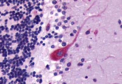 Immunohistochemistry-Paraffin: CXCR4 Antibody - BSA Free [NLS1380]