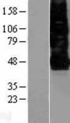 Western Blot: CXCR4 Overexpression Lysate [NBL1-09633]