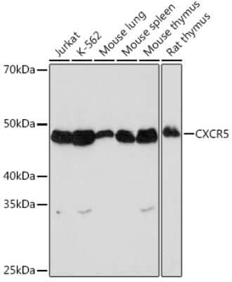 Western Blot: CXCR5 Antibody (9Q10I2) [NBP3-16723]