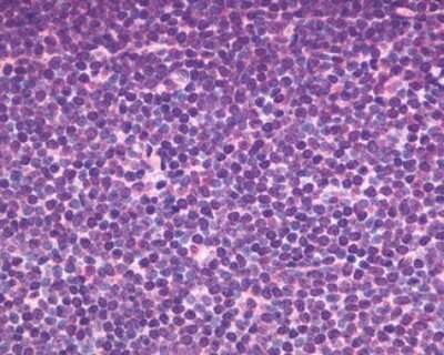 Immunohistochemistry-Paraffin: CXCR5 Antibody - BSA Free [NLS1384]