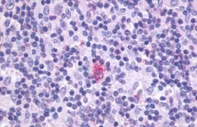 Immunohistochemistry-Paraffin: CXCR5 Antibody - BSA Free [NLS1384]