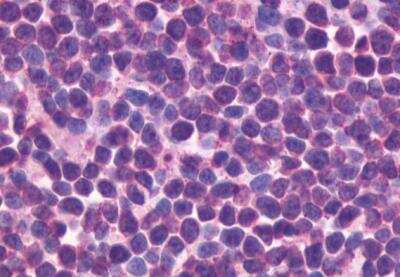 Immunohistochemistry-Paraffin: CXCR5 Antibody - BSA Free [NLS1384]