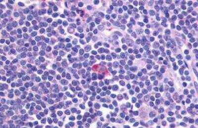 Immunohistochemistry-Paraffin: CXCR5 Antibody - BSA Free [NLS1384]
