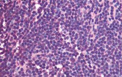 Immunohistochemistry-Paraffin: CXCR5 Antibody - BSA Free [NLS1384]