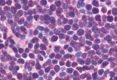 Immunohistochemistry-Paraffin: CXCR5 Antibody - BSA Free [NLS1384]