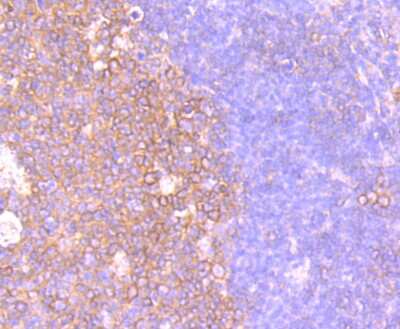 Immunohistochemistry-Paraffin: CXCR5 Antibody (JB11-40) [NBP2-75460]