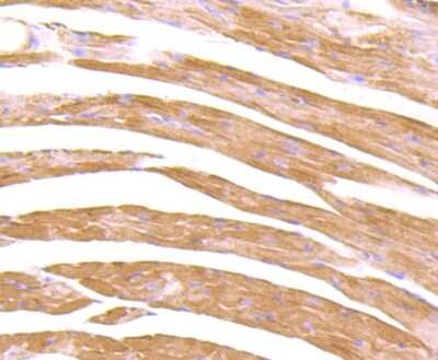 Immunohistochemistry-Paraffin: CXCR5 Antibody (JB11-40) [NBP2-75460]