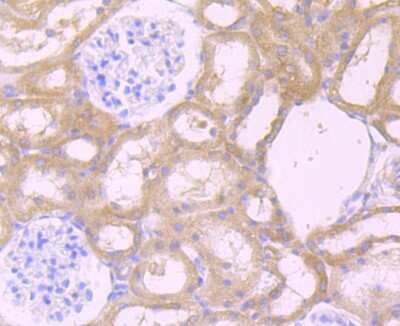 Immunohistochemistry-Paraffin: CXCR5 Antibody (JB11-40) [NBP2-75460]
