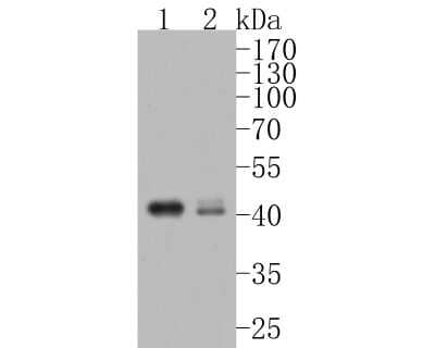 Western Blot: CXCR5 Antibody (JB11-40) [NBP2-75460]