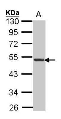 Western Blot: CXCR5 Antibody [NBP2-16045]