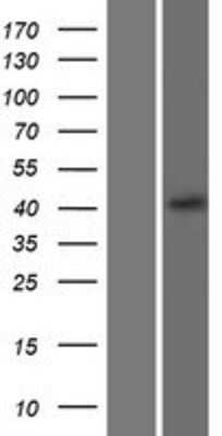 Western Blot: CXCR5 Overexpression Lysate [NBP2-08181]