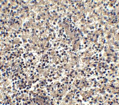 Immunohistochemistry: CXCR6 Antibody - BSA Free [NBP1-76871]