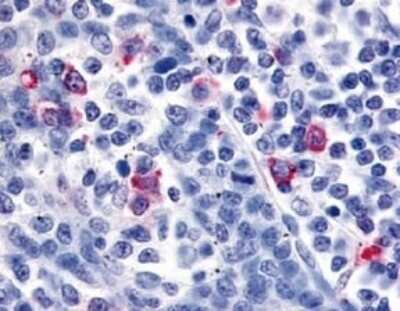 Immunohistochemistry-Paraffin: CXCR6 Antibody - BSA Free [NLS1102]